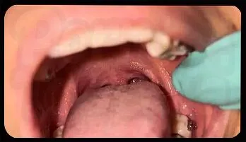 Sensual Tongue Tease with Cassy Braces Fast streaming