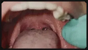 Sensual Tongue Tease with Cassy Braces