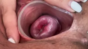 Taking it all with a tiny cervix