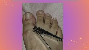Cutting my toenails
