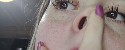 Runny Nose Close up