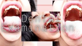 Oral examination: crooked teeth, tongue, molars, throat