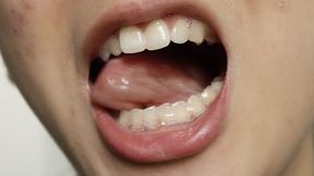 Aurora's Teeth Give You A Show