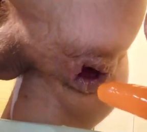 My Squelchy Swollen Prolapse Enjoys This