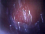 Deep look inside cum filled ass with endoscope