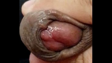 A closer look to my leaking precum. February 8, 2026.