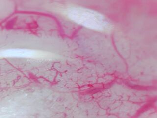 Camera Inside Ass, 9 Throbbing Pulsing Anal Orgasms, Live Stethoscope Heartbeat - Full Video