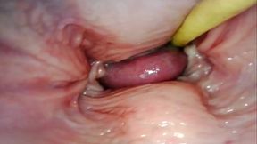 Mature Anal Whore Gapes Wide for Creampie