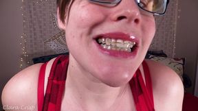 tempting you into cumming on my retainers - bbw milf mouth