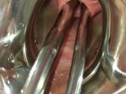 Piss Re-injection - Female Urethral Sounding - BDSM Stretched Wide Peehole