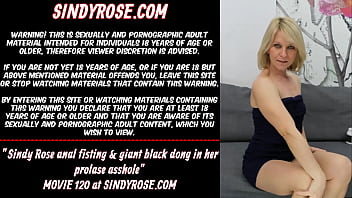 Sindy Rose anal fisting &amp_ giant black dong in her prolapse asshole