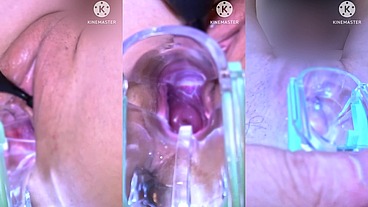 The pussy before and after the creampie中だし前と 中だし後のマンコ