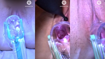 The pussy before and after the creampie中だし前と 中だし後のマンコ