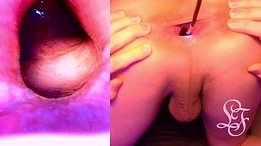 Split Screen Look inside Lina's Gaping Ass with Eggs