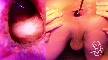 Split Screen Look inside Lina's Gaping Ass with Eggs