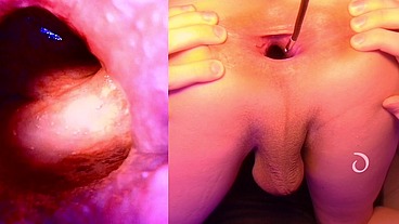 Split Screen Look inside Lina's Gaping Ass with Eggs