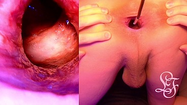 Split Screen Look inside Lina's Gaping Ass with Eggs