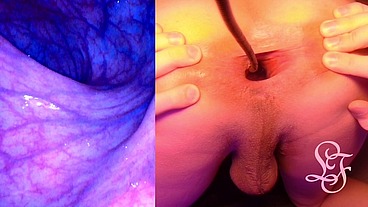 Split Screen Look inside Lina's Gaping Ass with Eggs