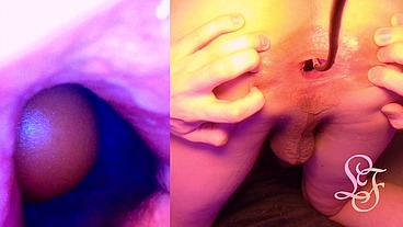 Split Screen Look inside Lina's Gaping Ass with Eggs
