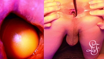 Split Screen Look inside Lina's Gaping Ass with Eggs