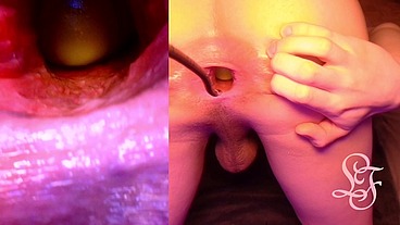 Split Screen Look inside Lina's Gaping Ass with Eggs