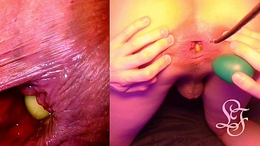 Split Screen Look inside Lina's Gaping Ass with Eggs