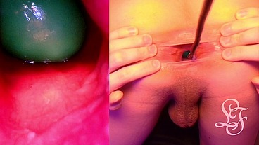 Split Screen Look inside Lina's Gaping Ass with Eggs