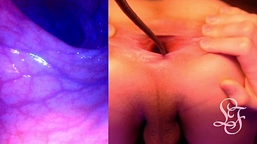 Split Screen Look inside Lina's Gaping Ass with Eggs
