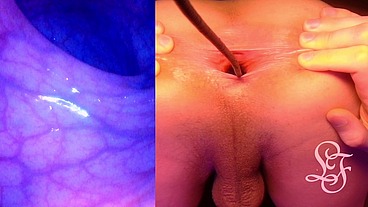 Split Screen Look inside Lina's Gaping Ass with Eggs