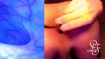 Split Screen Look inside Lina's Gaping Ass with Eggs