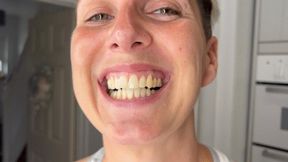 Frankie’s mouth inspection