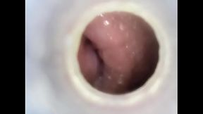 Endoscope in urethra