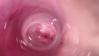 "Camera deep inside Mia&#039;s creamy pussy, teen Cervix close up"