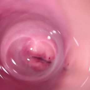 Camera deep inside Mia&#039;s creamy pussy, teen Cervix close up