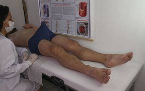 Nurse Observes Patient's Erection