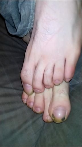 Foot Fancies