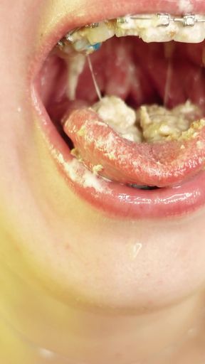 Epic moment from &quot;eating in braces - vore and food fetish - close up video&quot;