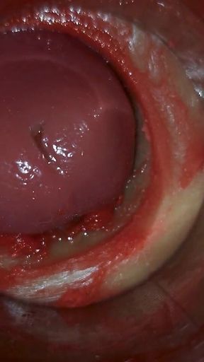 Camera Inside Deep Pussy Captures Huge Ejaculation of Sperm Asmr