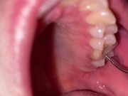 Ultrasonic teeth cleaning. Teeth fetish.
