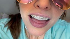 Giantess Vore with Braces