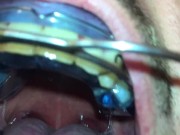 New Braces retainer and Twinblock with headgear for new aventures
