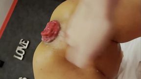 Monika Fox Is Prolapse Queen! The Most Beautiful Roses 2022! (Free)