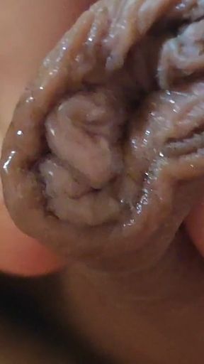 Large Foreskin and Balls in Striking Close-up.