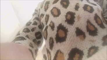 a terrible anal prolapse hurts me