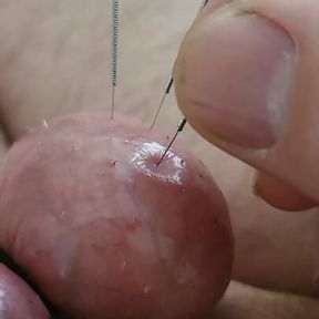 Needles in an egg