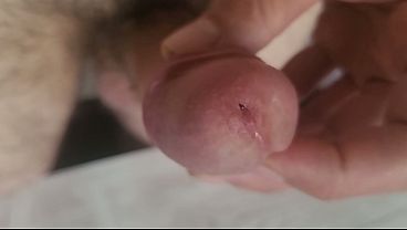 One finger Frenulum fun