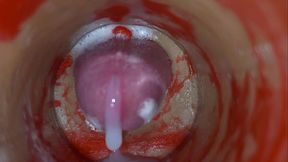 Insemination - Internal Camera Captures Deep Male Ejaculation