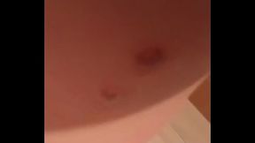 Sunt &icirc_mpușcat cu un airsoft in pulpa provoc&acirc_nd &icirc_mi o rana