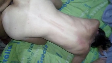 Ai, ai, tá ardendo, ai meu cú