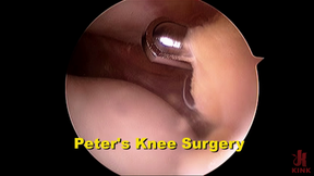Peter's Recovery